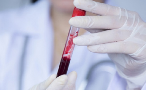 Día del Cáncer en Sangre: síntomas que no debés ignorar