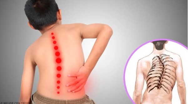 Atrofia muscular espinal: aprueban terapia génica