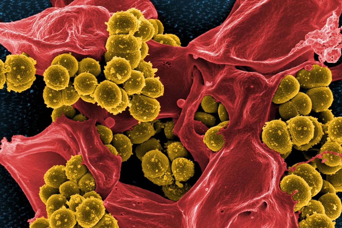 Confirman en Paraguay la presencia de una superbacteria resistente a antibióticos